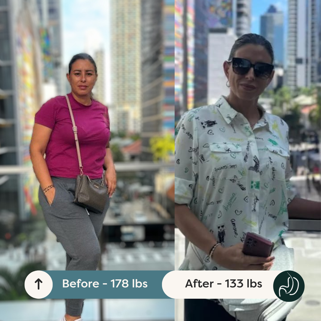 Before and After